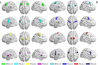 Altered coupling of resting-state cerebral blood flow and functional connectivity in Meige syndrome